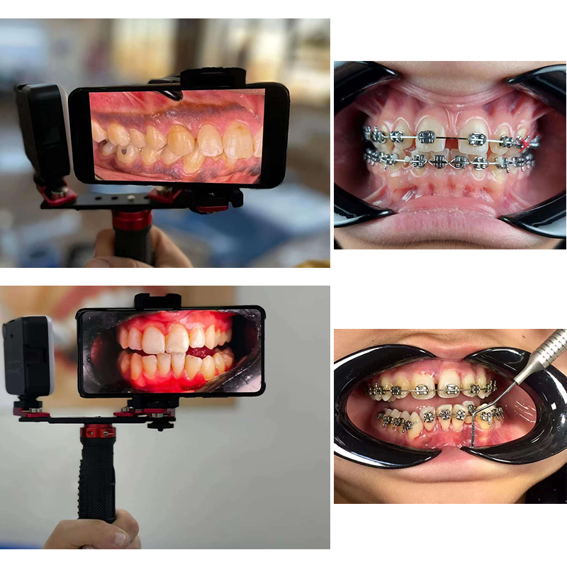 Dentistry Material Mobile Phon - Photography With Mobile 评论和价格
